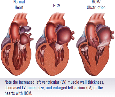 figure of three hearts with labels