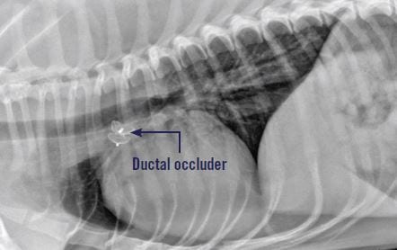 Thoracic radiograph revealing Amplatz ductal occluder